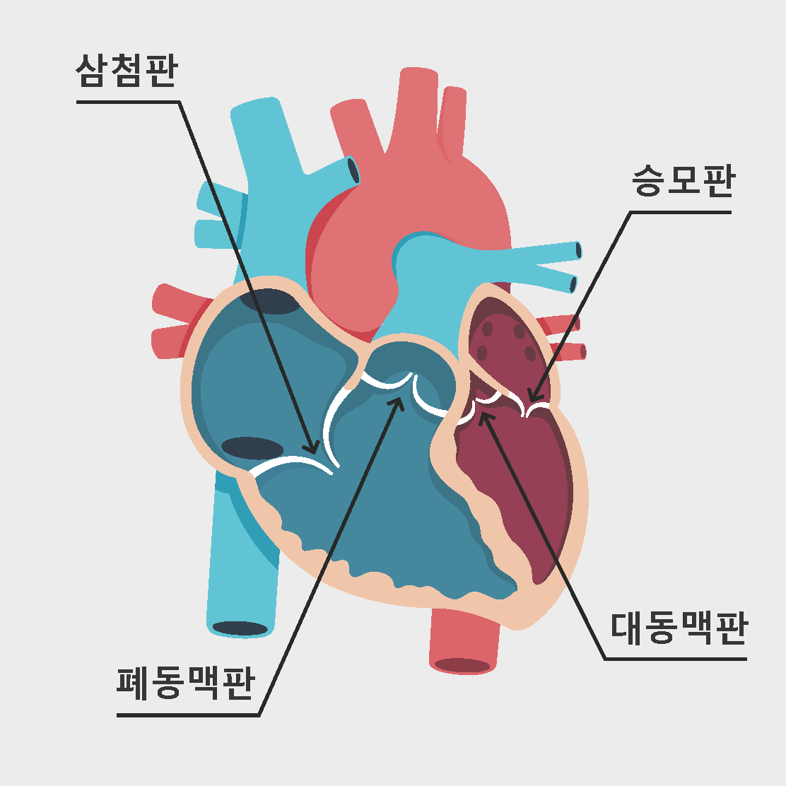 심장 판막 질환이란 무엇인가요?