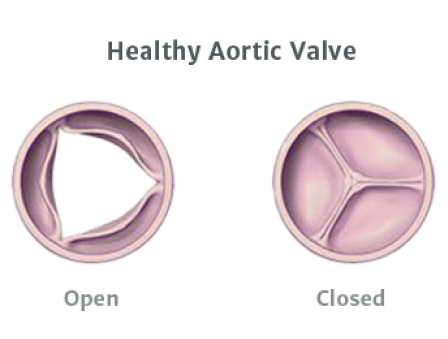 Healthy Aortic Valve