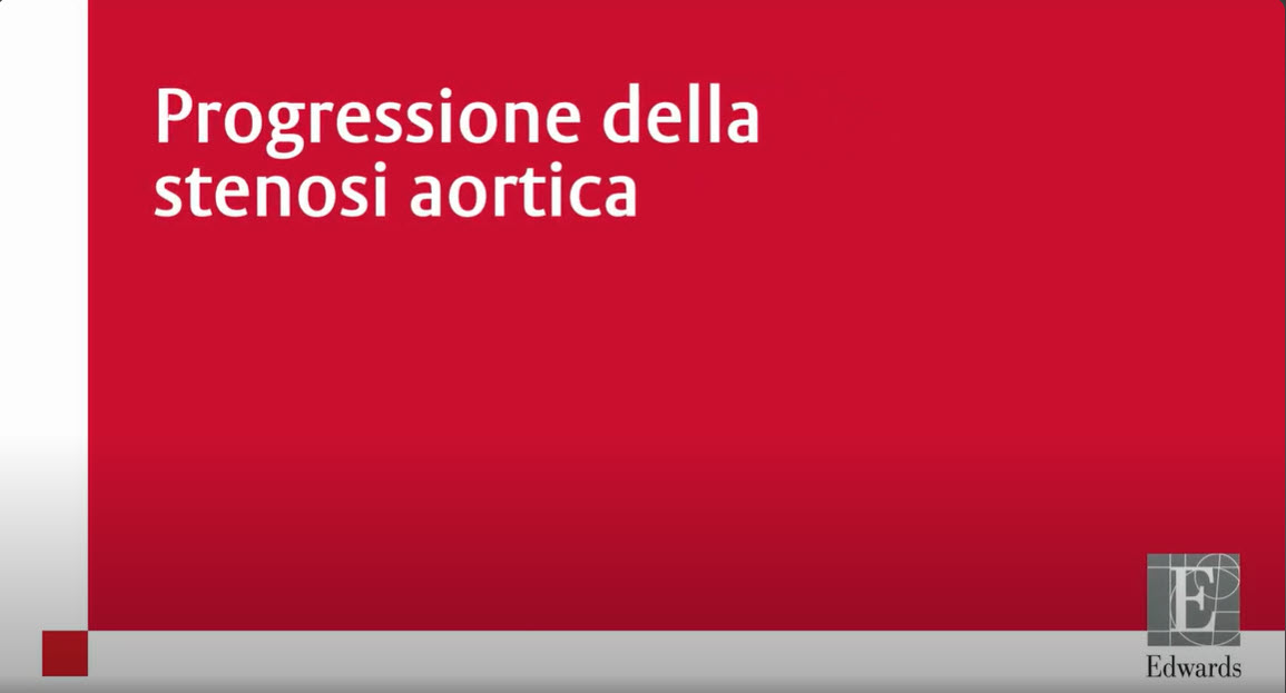 What is Aortic stenosis thumbnail