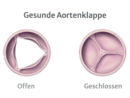 Healthy Aortic Valve