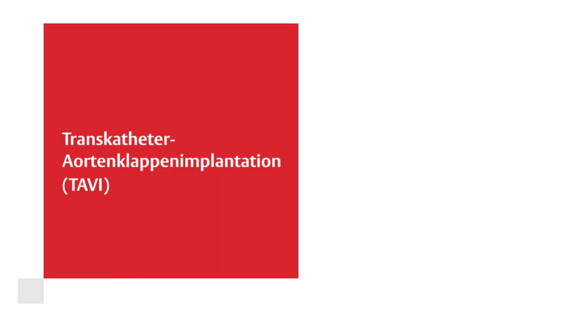 Transcatheter Aortic Valve Implantation (TAVI)