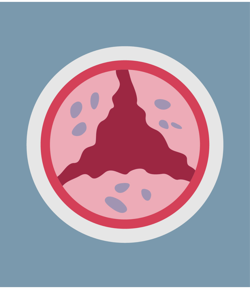 Moderate