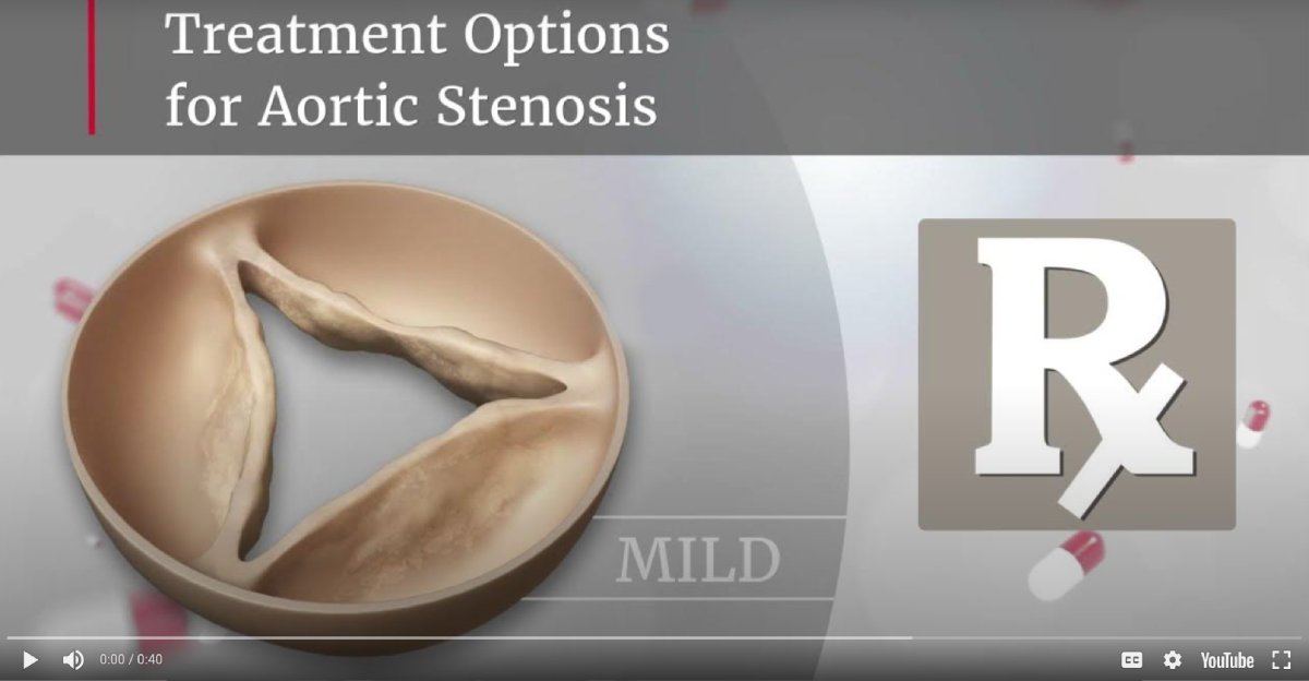 treatment options