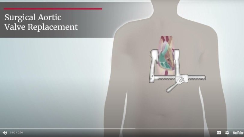 Surgical Video